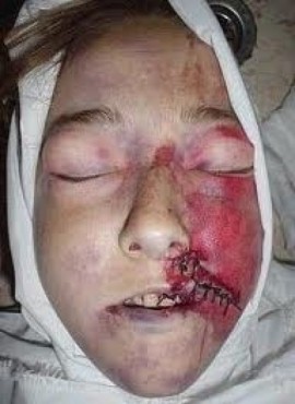 Rachel Corrie et Shirine Abou Akla